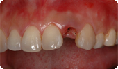 case1_1