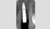 case1_2