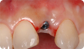 case1_3