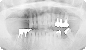 case2_1