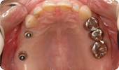 case2_2