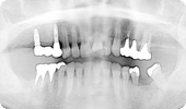 case2_3