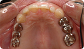 case2_4