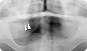 case4_1