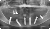 case4_2