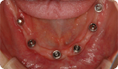 case4_3