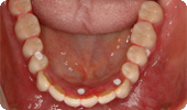 case4_4