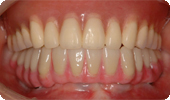 case4_5