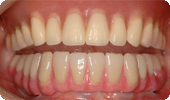 case4_6