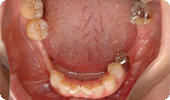 case5_1