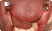 case5_2