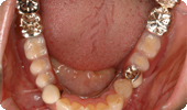 case5_3