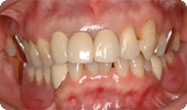 case5_4
